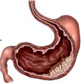 縻烂性胃炎可以吃老鼠瓜